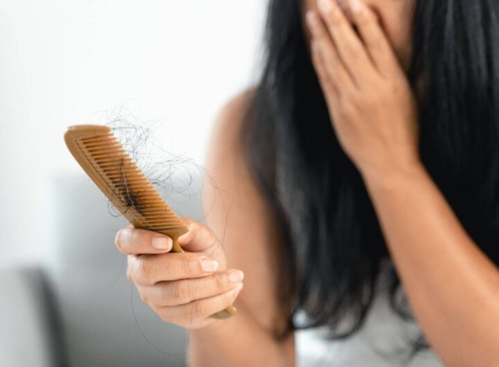 caduta capelli
