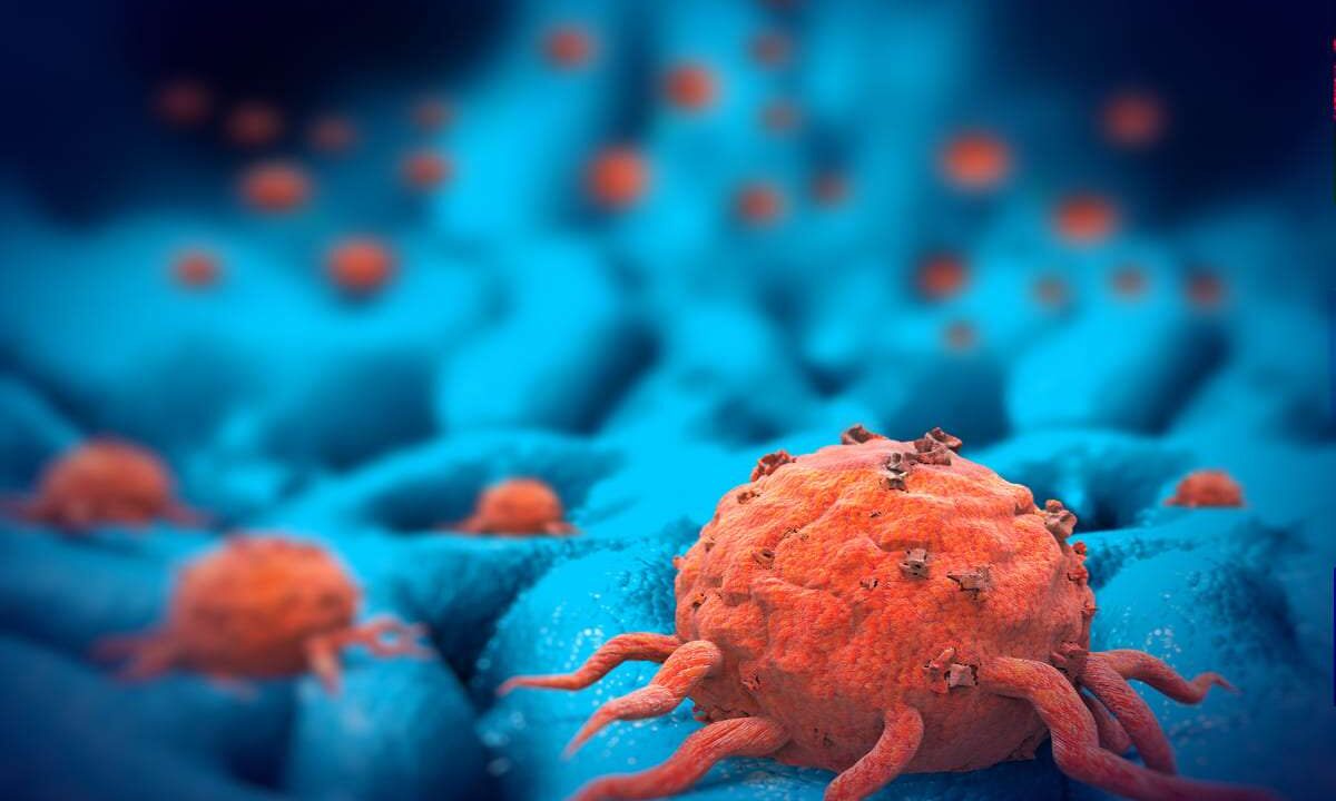 cellule cancro