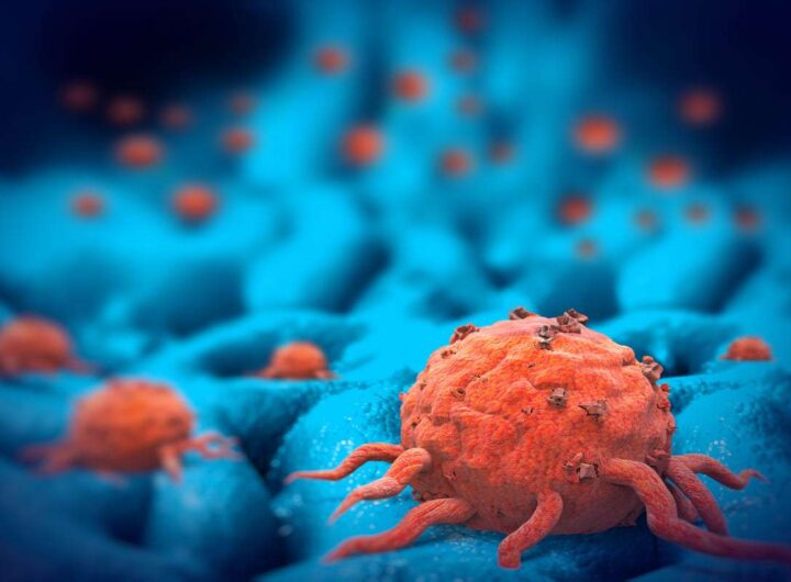 cellule cancro