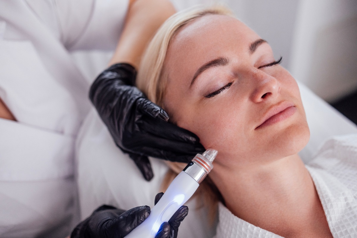 Procedura estetica con tecnologia laser